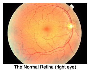normal retina symptoms